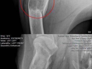 bone cancer x-ray