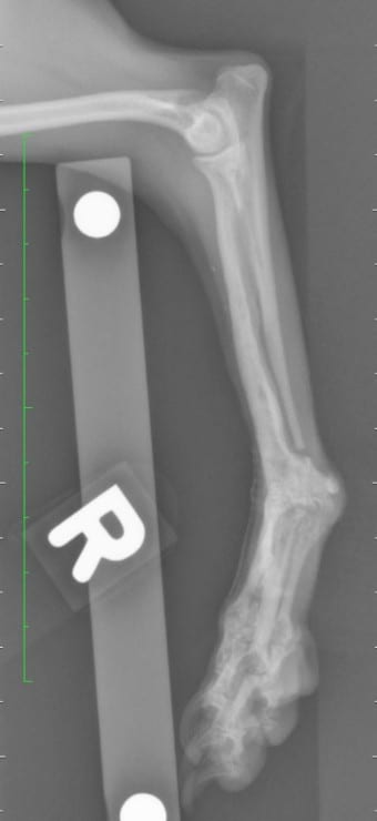 BMP Alternative Limb Sparing Surgery Success