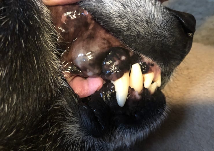 Benign odontogenic cyst (possible lateral periodontal cyst)