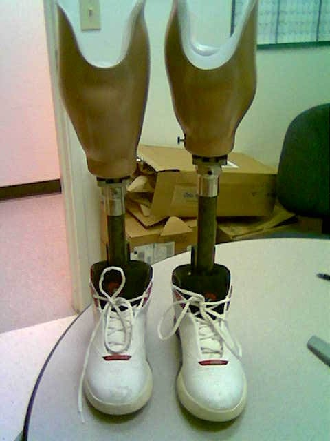 Prosthetic limbs