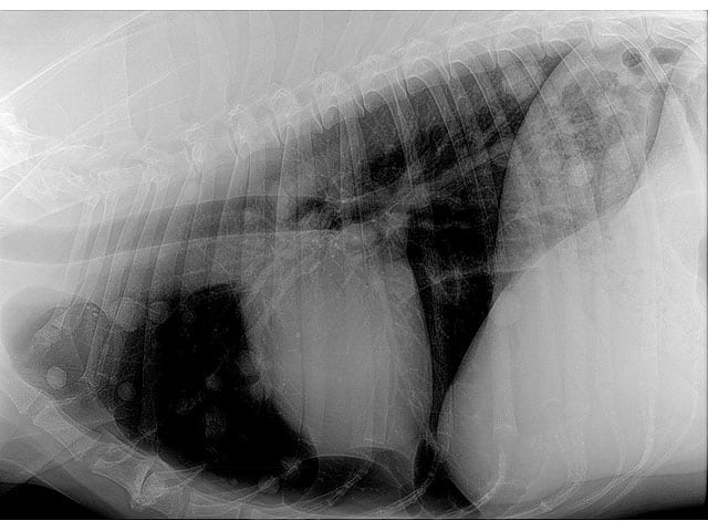 Osteosarcoma Lung mets xray at 2 months without amputation