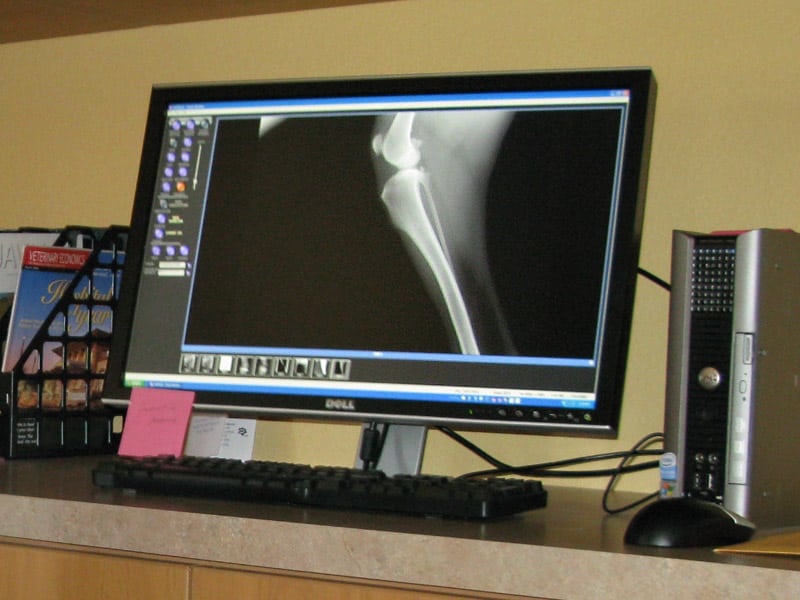 Digital leg x-ray shows no recurrence of osteosarcoma