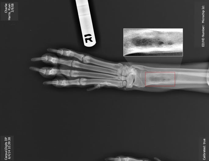 Canine osteosarcoma x-ray