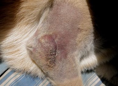 soft tissue sarcoma